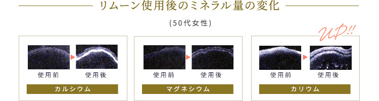 家庭用電位・温熱治療器リムーン